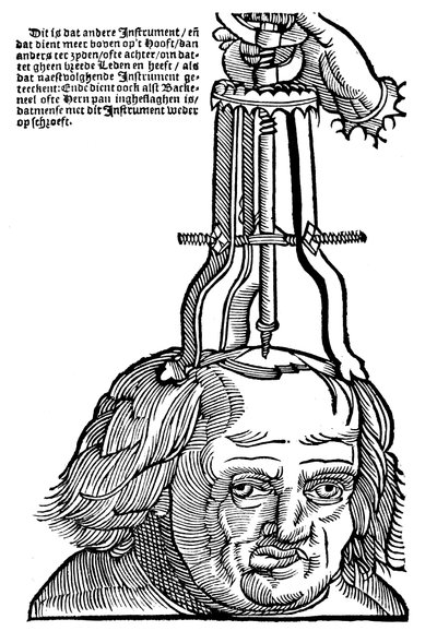 Trefinação, 1593 de Unbekannt