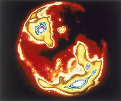 Imagem de raios X do sol, Skylab, década de 1970 de Unbekannt