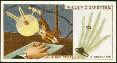 Radiografando a mão, 1924 de Unbekannt