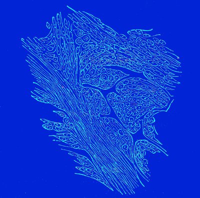 Secção transversal de tumores fibro-nucleados de Unbekannter Künstler