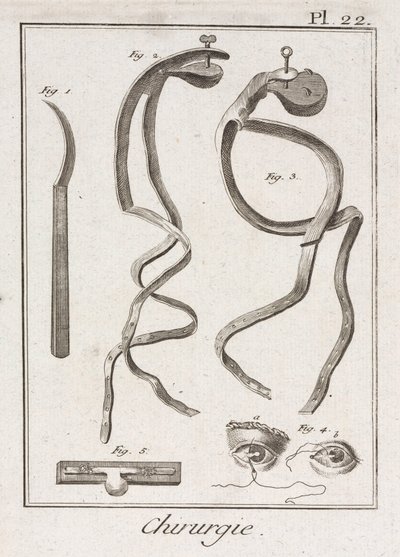 Equipamento, Cirurgia Oftalmológica Precoce-Moderna de Unbekannt