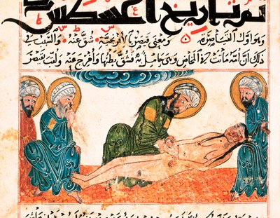 Representação do parto cesáreo. Miniatura retirada de um manuscrito de medicina de Abu Raihan Al-Biruni (ou Alberuni) (973-1048), intelectual e cientista persa, fólio 161. de Unbekannt