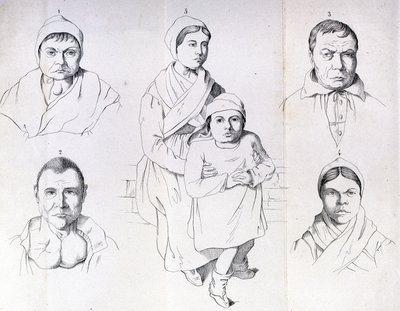 Considerações sobre as causas do cretinismo endémico de Morel. de Unknown artist
