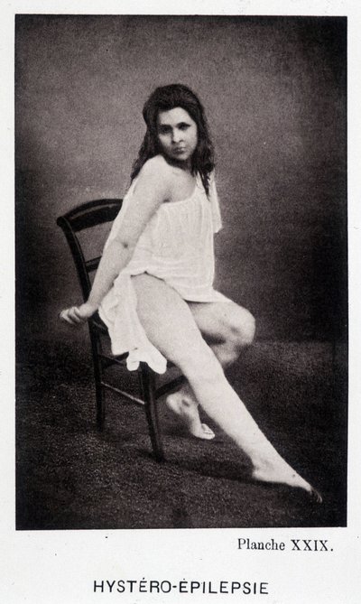 Hystero Epilepsie - Contractura em "Iconografia fotográfica da Salpétrière: serviço de Mr. Charcot" de Paul Regnard e Bourneville de Unknown artist