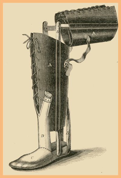 Beinersatz von Unknown Artist