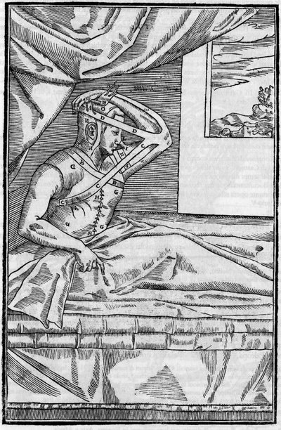 Cirurgia no nariz: Cirurgia reconstrutiva no nariz em "De curtorum chirurgia per insitionem". Veneza de Unknown artist