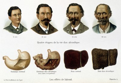 Os efeitos do álcool: as quatro fases da vida de um alcoólico representadas pelo seu rosto e fígado. - em "a mulher, médica doméstica". de Unknown artist