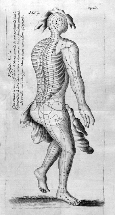 De Acupunctura, de W.Ten Rhijne. Londres, 1683. Primeiro texto ocidental que trata da Acupuntura. de Unknown artist