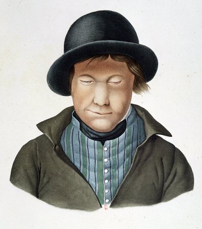 Leprosos da Islândia, cerca de 1840, B.N. de Unknown artist