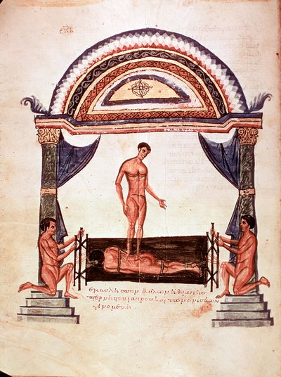 Medicina: redução da coluna deslocada - o paciente é fixado em uma tábua de madeira, um dos terapeutas fica em pé nas costas (manuscrito de Unknown artist