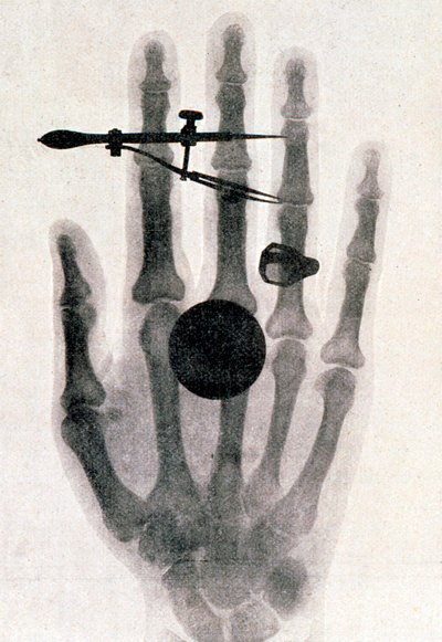 Fotografia da mão da esposa de Wilhelm Roentgen com raios X, 1896 de Wilhelm Conrad Rontgen