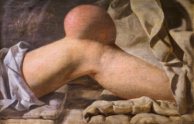 Um inchaço na região patelar [joelho] de Wilhelm Ferdinand Bendz