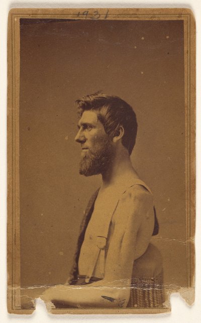 [Vítima da Guerra Civil não identificada de perfil, sentada] de William H. Bell