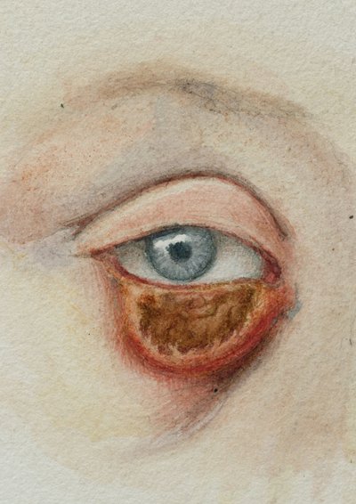 Olhos de Frederick (attr. to) Barnard