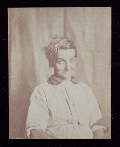 Retrato psiquiátrico de um paciente, Surrey County Asylum, c 1852 de John Pardon
