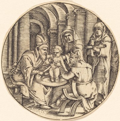 A circuncisão de after Master IB