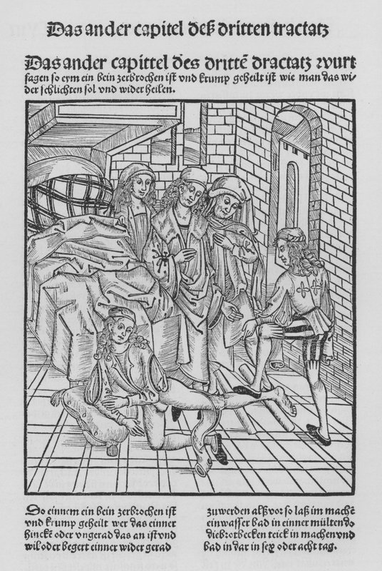 O Livro de Cirurgia de Hieronymus Brunschwig (litho) de (after) German School