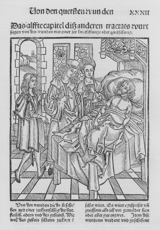 O Livro de Cirurgia de Hieronymus Brunschwig (litho) de (after) German School