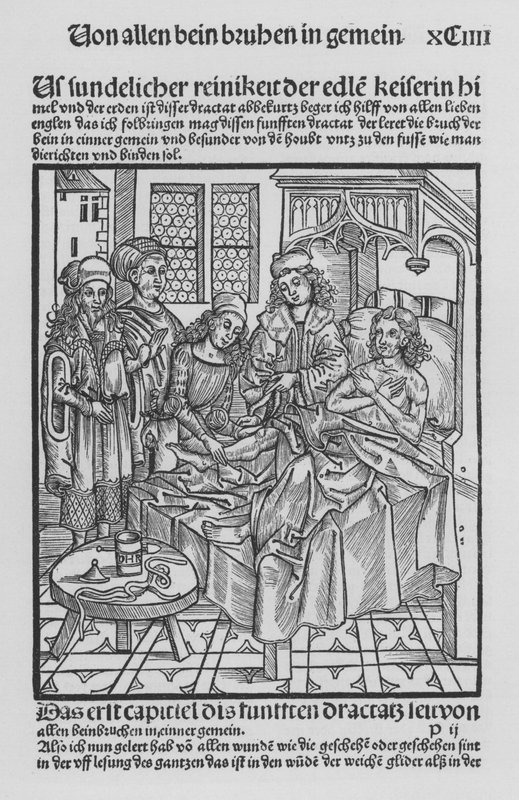 O Livro de Cirurgia de Hieronymus Brunschwig (litho) de (after) German School