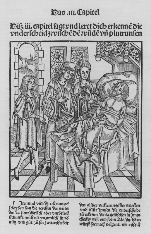 O Livro de Cirurgia de Hieronymus Brunschwig (litho) de (after) German School