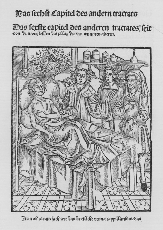 O Livro de Cirurgia de Hieronymus Brunschwig (litho) de (after) German School