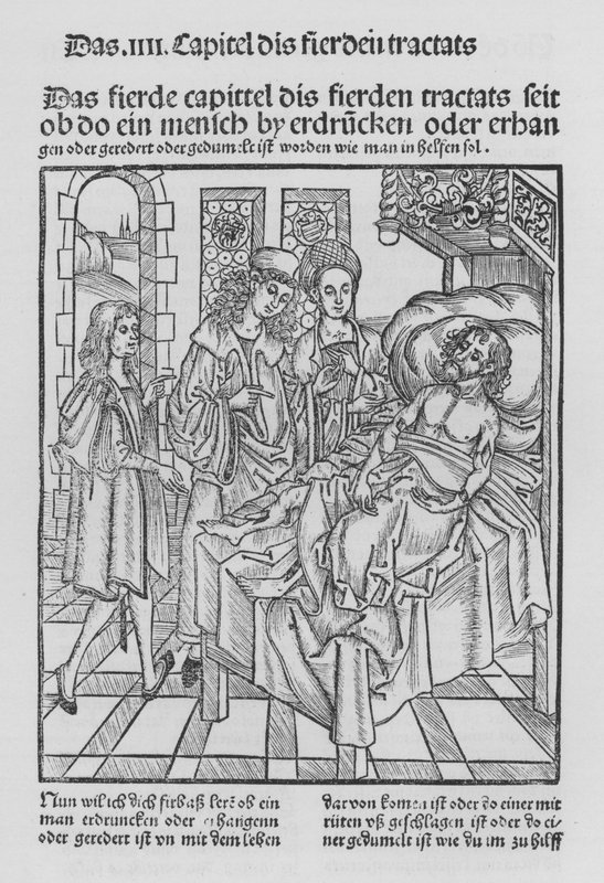 O Livro de Cirurgia de Hieronymus Brunschwig (litho) de (after) German School