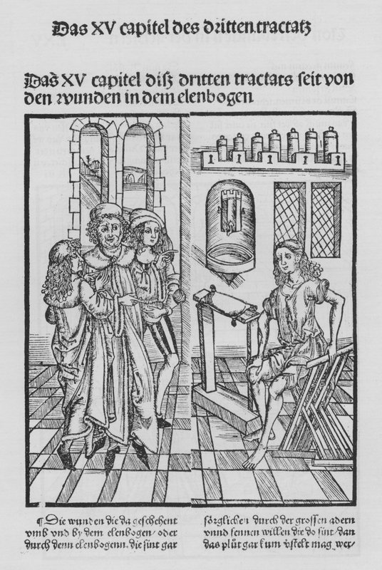 O Livro de Cirurgia de Hieronymus Brunschwig (litho) de (after) German School