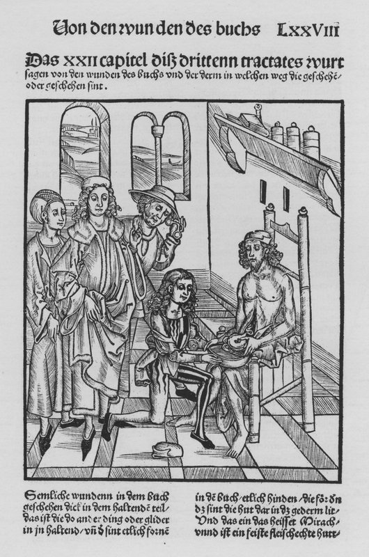 O Livro de Cirurgia de Hieronymus Brunschwig (litho) de (after) German School