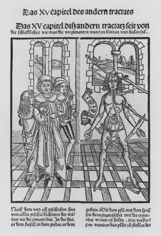 O Livro de Cirurgia de Hieronymus Brunschwig (litho) de (after) German School