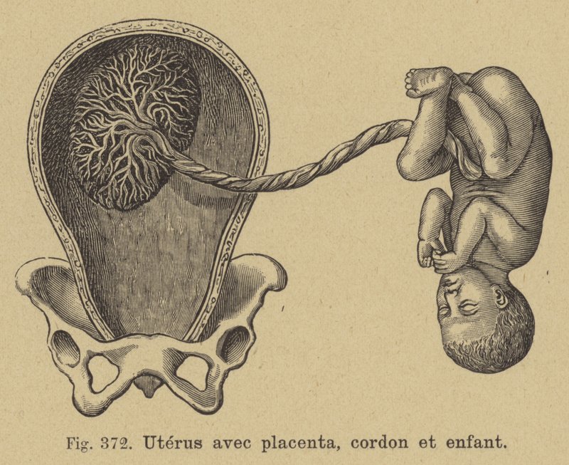 Corte de um útero mostrando a placenta, cordão umbilical e bebê de German School