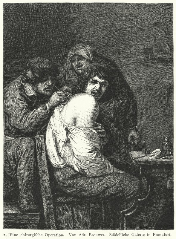 A Operação de Costas de Adriaen (after) Brouwer