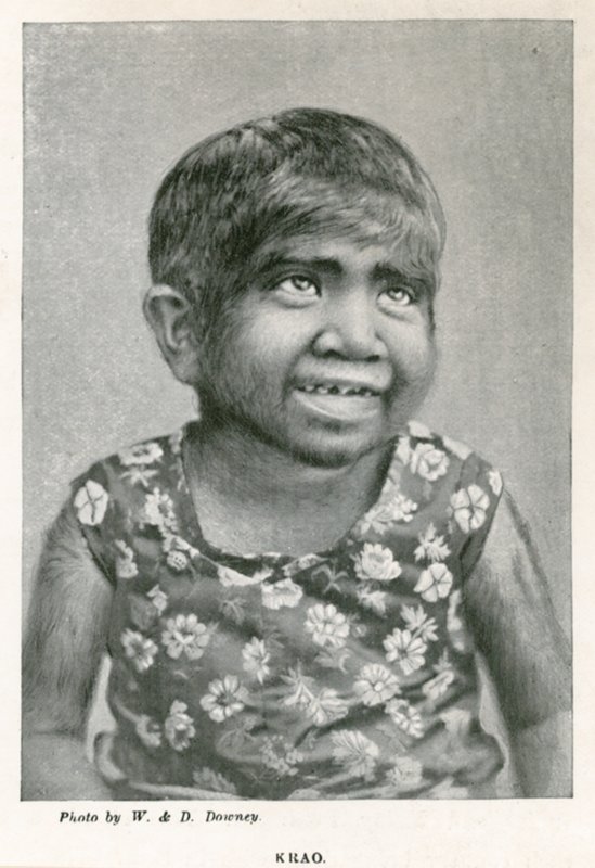 Krao, The Missing Link, exibido no aquário, Westminster, Londres, em 1887 de English Photographer