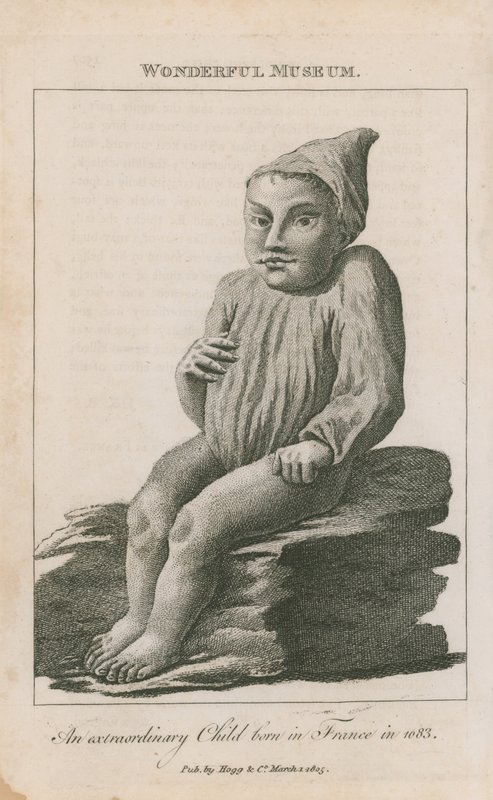 Uma criança extraordinária nascida na França em 1683 de English School