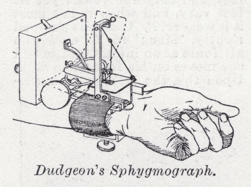 Esfigmógrafo de Dudgeon (litho) de English School
