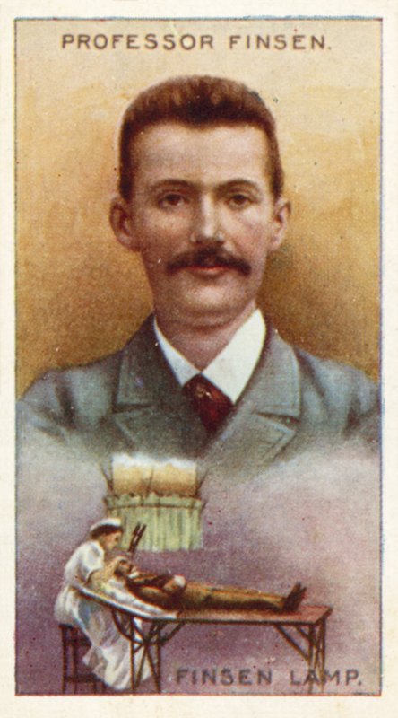 Professor Finsen, lâmpada de Finsen de English School