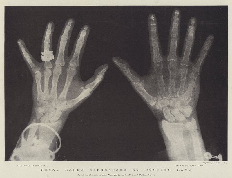 Royal Hands reproduzido por Rontgen Rays (gravura) de English School