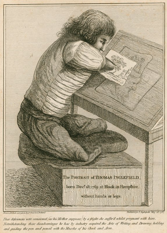 Thomas Inglefield, nascido em 18 de dezembro de 1769 em Hook, Hampshire, sem braços ou pernas de English School