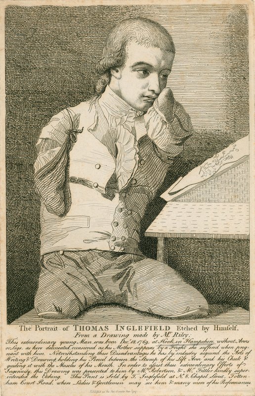 Thomas Inglefield, nascido em 18 de dezembro de 1769 em Hook, Hampshire, sem braços ou pernas de English School