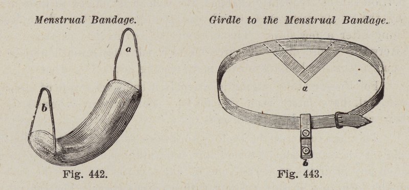 Ligadura menstrual; Cinturão para a ligadura menstrual (litho) de European School