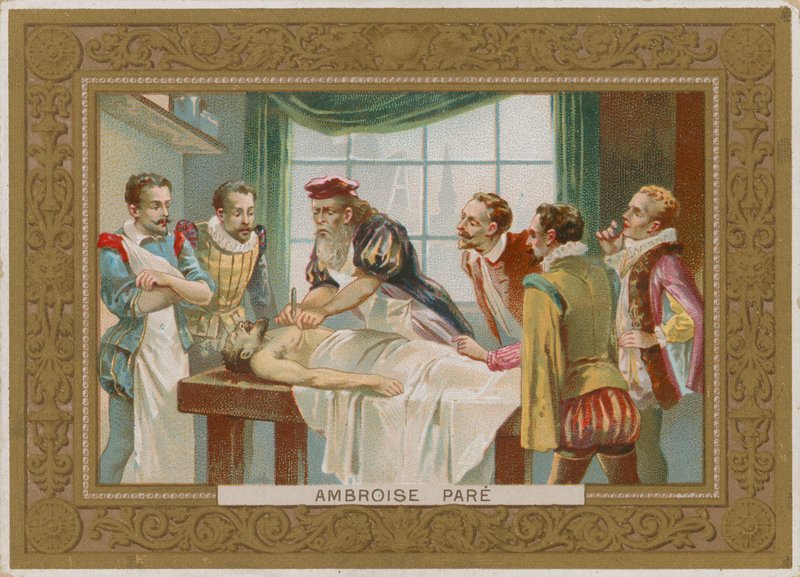 Ambroise Pare, cirurgião francês do século 16 de French School