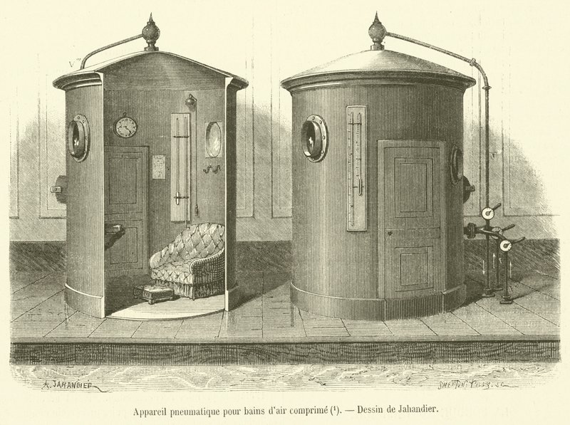 Aparelho pneumático para banhos de ar comprimido (gravura) de French School