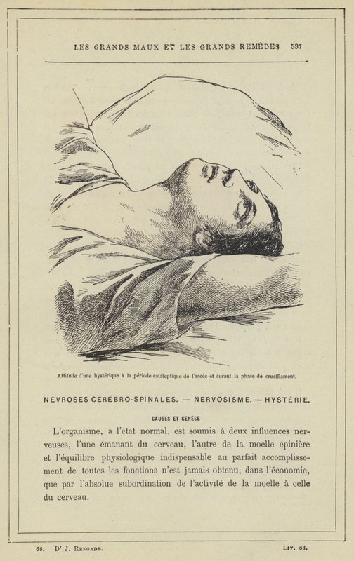 Atitude de um histérico durante o período cataléptico de acesso e durante a fase de crucificação (cor litho) de French School