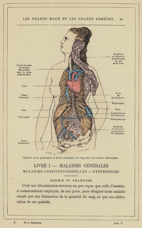 Órgãos da produção e circulação do sangue em uma mulher clorótica (cor litho) de French School