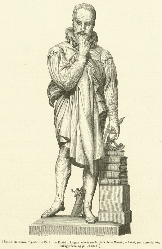Estátua de Bronze de Ambroise Pare (gravura) de French School