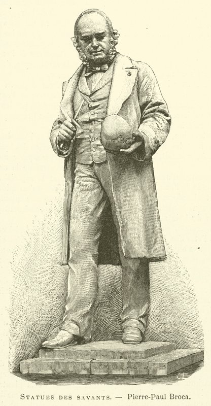 Estátuas de estudiosos, Pierre-Paul Broca (gravura) de French School