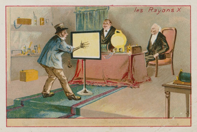 Raios-X de French School