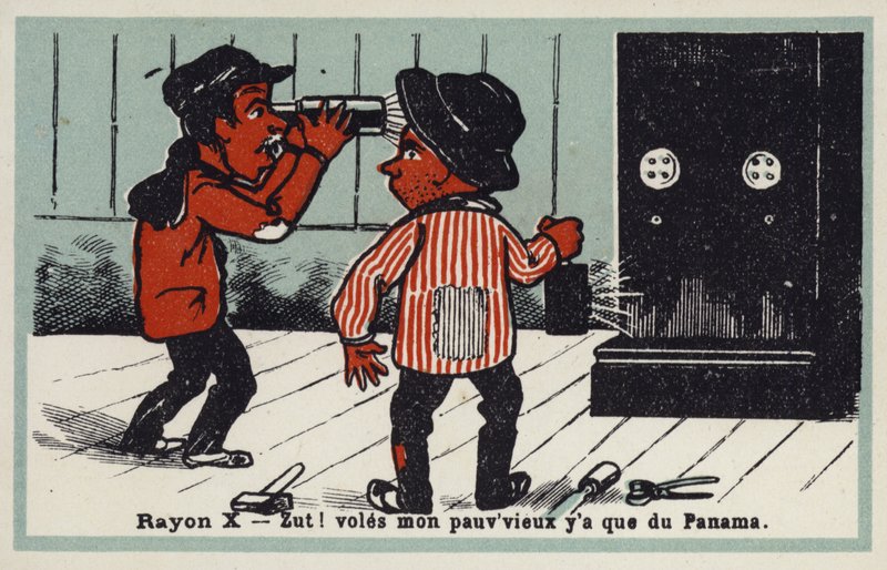 Raios X - quebra-ventos frustrados de French School