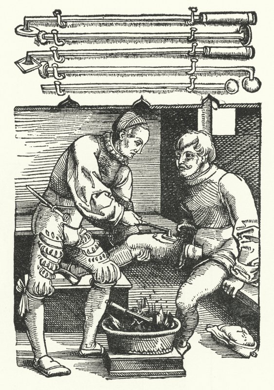 Um cirurgião que cauteriza uma ferida na perna de um soldado (gravura) de German School