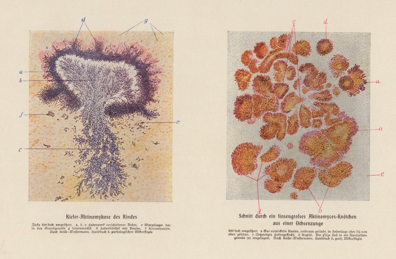 Actinomyces bovis (litografia a cores) de German School