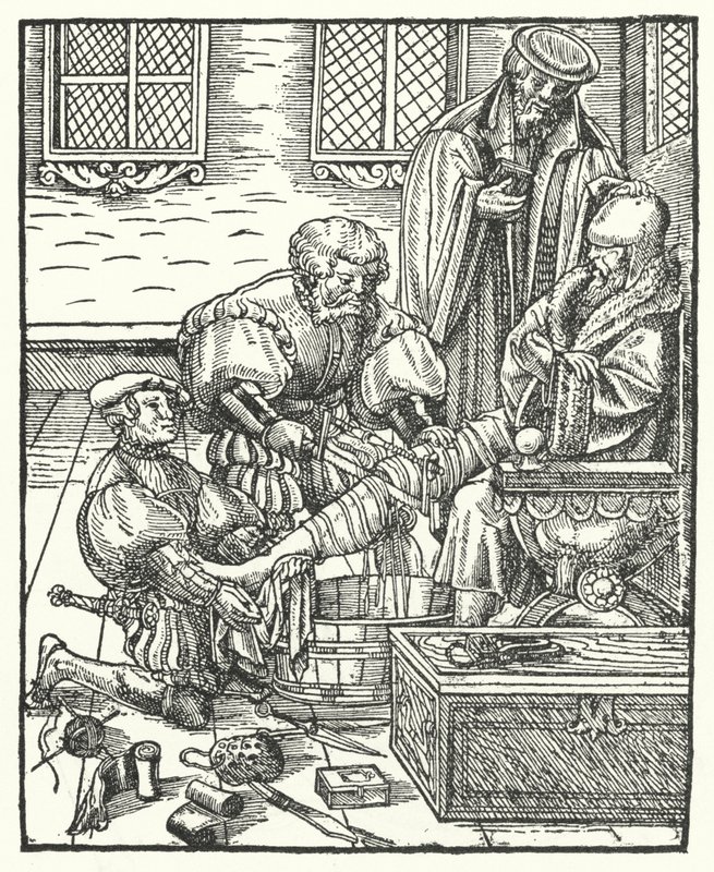 Uma Amputação (gravura) de German School